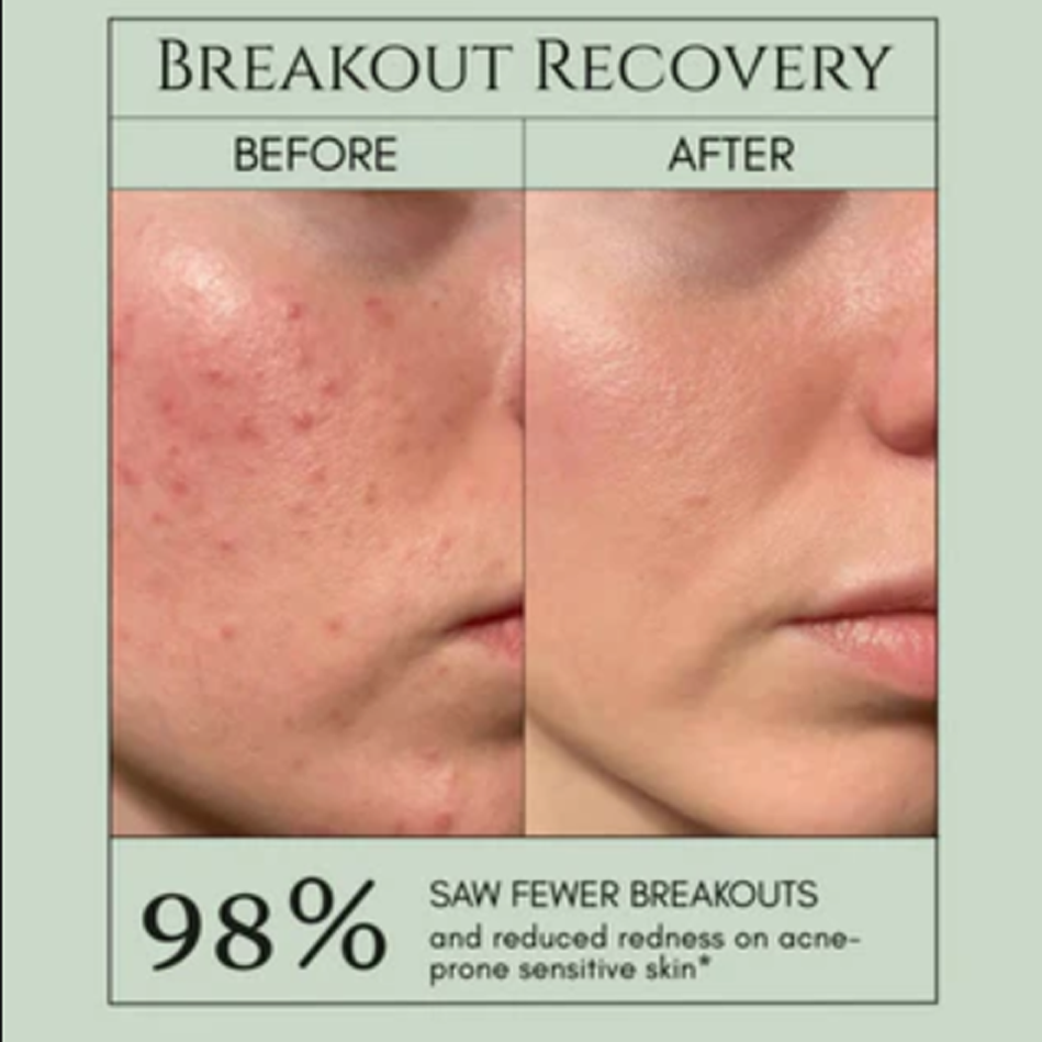 Holy Basil Bubble Deep Mask