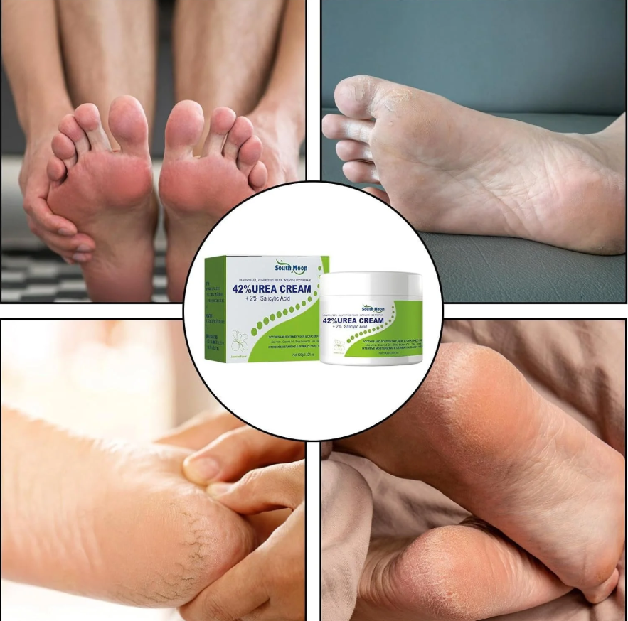 South Moon - 42% Urea Cream