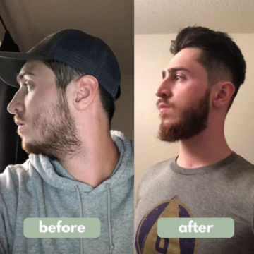 Scalp Hair Growth Serum